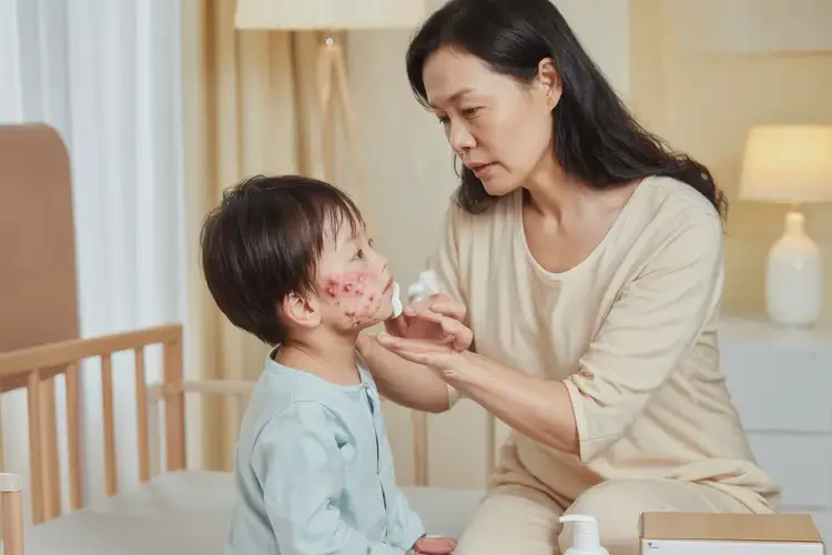 少兒脖子偶爾長濕疹可以徹底自愈嗎(圖3)