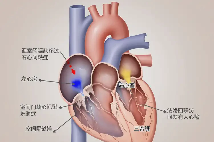 孕10周4天胎心77有危險嗎(圖2)