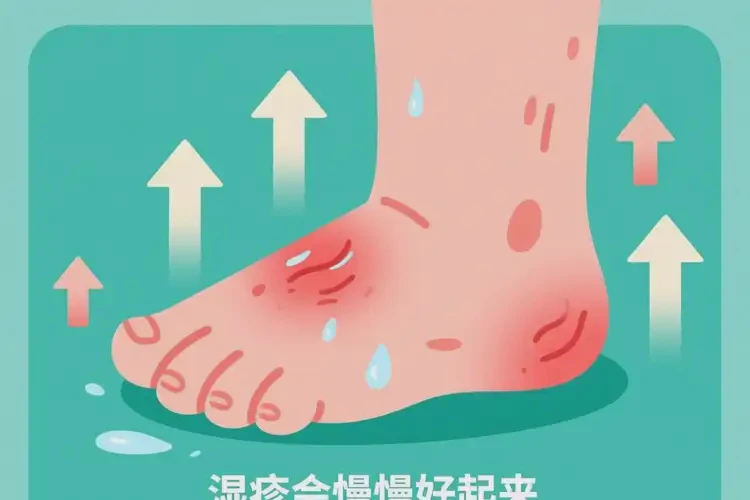 少儿脚上容易长湿疹能靠自己自愈吗(图1)