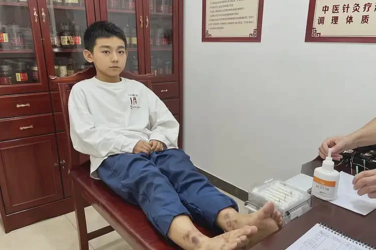 青少年腳上經(jīng)常起濕疹能夠徹底治愈嗎(圖1)