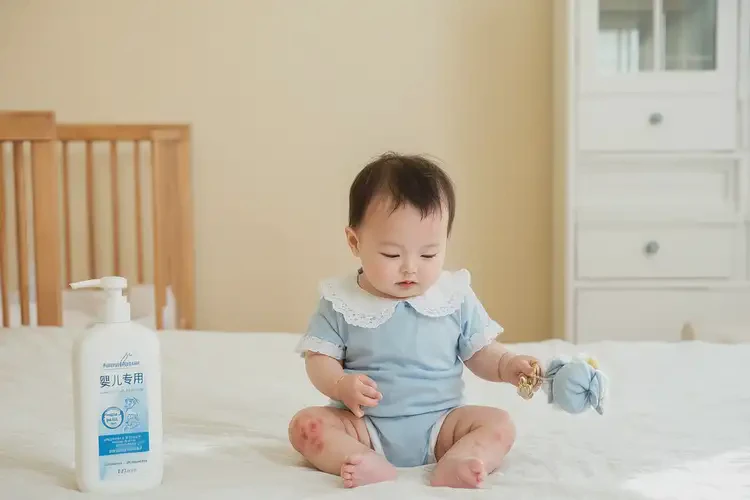 嬰兒脖子上出現(xiàn)濕疹可以徹底自愈嗎(圖2)