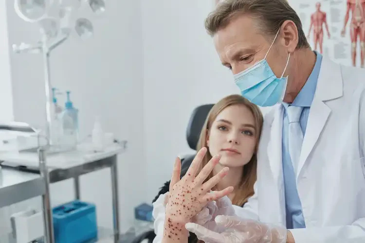 女人手上出現(xiàn)濕疹不管它會(huì)自己自愈嗎(圖2)