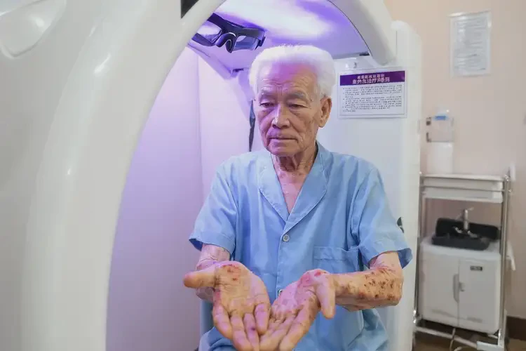 高齡老人手上長(zhǎng)濕疹不管它會(huì)自己痊愈嗎(圖1)