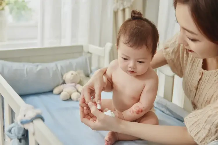 新生兒手上出濕疹能夠徹底治愈嗎(圖3)