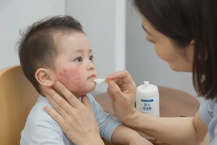 小孩脖子上起濕疹能徹底自愈嗎(圖2)