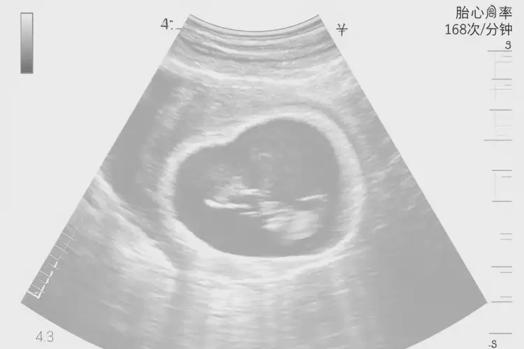 孕3周3天胎心166正常嗎(圖4)