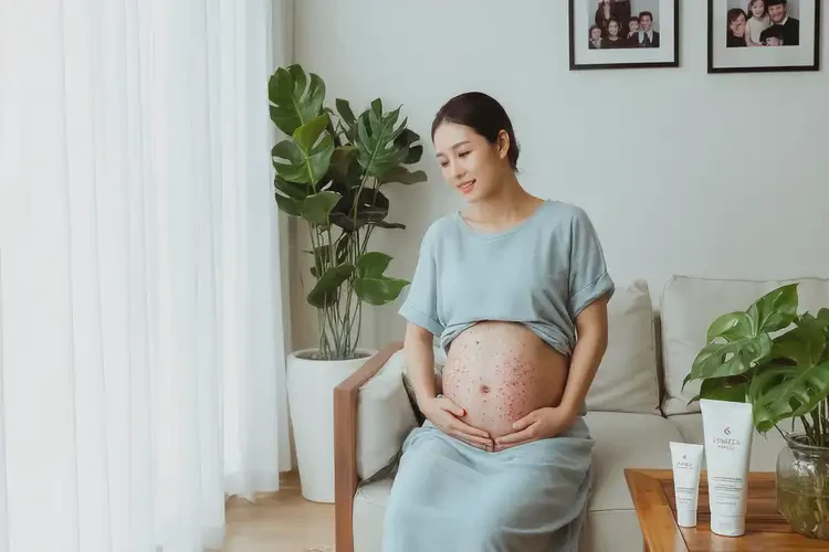 孕婦身上偶爾起濕疹可以徹底自愈嗎(圖3)