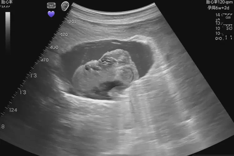 懷孕40多天胎心率85寶寶還能要嗎(圖1)