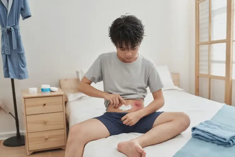 青少年肚子容易長濕疹可不可以徹底自愈(圖2)