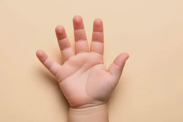 寶寶手上起濕疹可不可以徹底自愈(圖4)