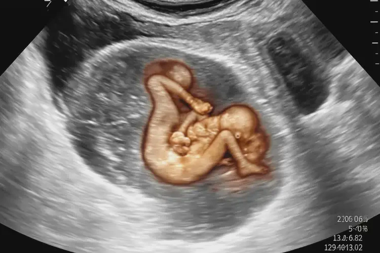 孕19周1天胎心165正常嗎(圖3)