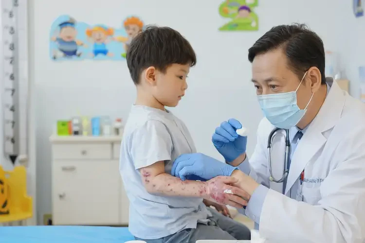 少兒手上出濕疹可不可以徹底自愈(圖2)