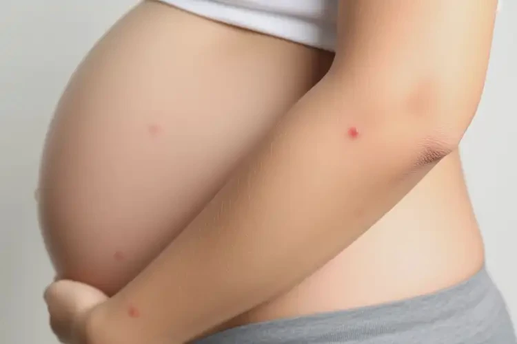 孕妇手臂上出湿疹不管它会自己自愈吗(图4)