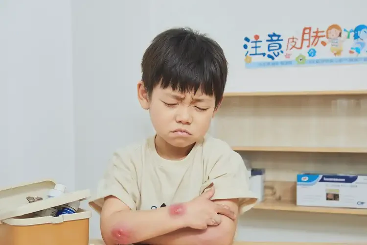 少兒手臂起濕疹可不可以徹底自愈(圖2)