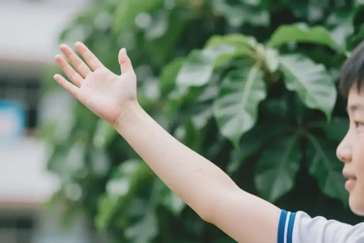 中學(xué)生手臂上偶爾起濕疹可以徹底自愈嗎(圖3)