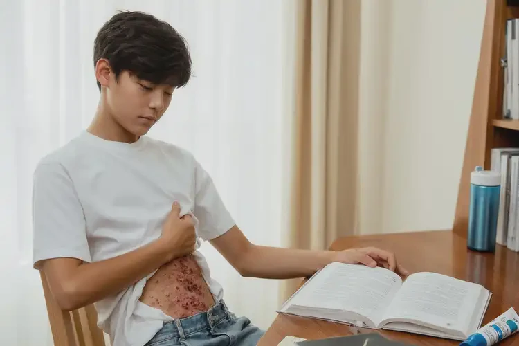 大學(xué)生肚子上容易起濕疹能不能徹底自愈(圖2)