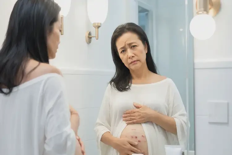 女性肚子偶尔起湿疹可不可以彻底自愈(图3)