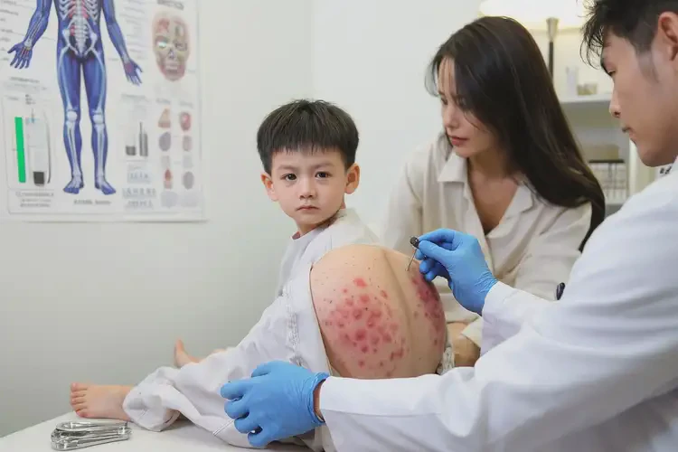 兒童屁股上經(jīng)常長濕疹不管它會自己好嗎(圖4)