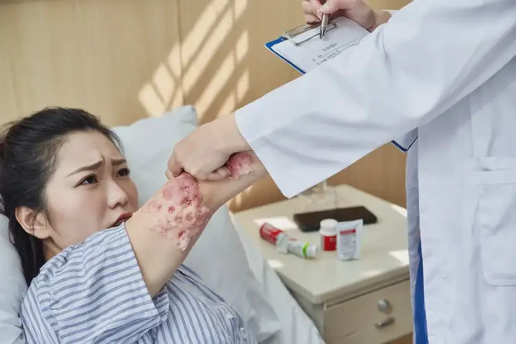 產(chǎn)婦手臂上出現(xiàn)濕疹不管它會(huì)自己痊愈嗎(圖4)