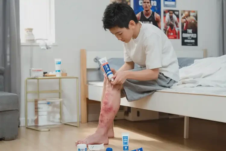 青少年小腿容易起濕疹能夠徹底治愈嗎(圖3)