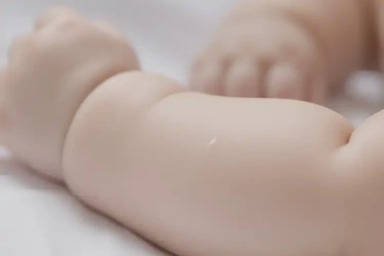 寶寶手臂上偶爾長濕疹不管它會自己好嗎(圖3)