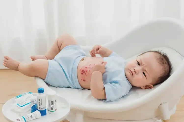 幼儿肚子起湿疹不管它会自己自愈吗(图3)