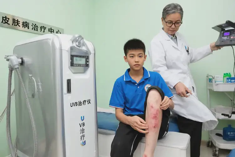 中學生小腿上長濕疹能夠徹底治愈嗎(圖2)