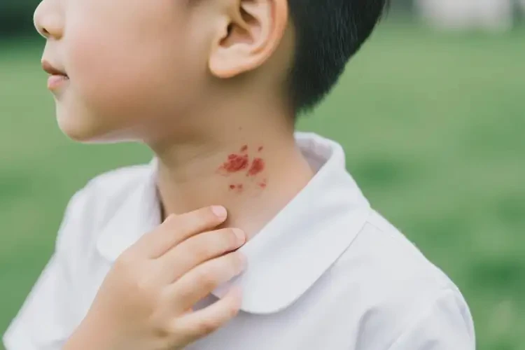 小學(xué)生脖子上偶爾長(zhǎng)濕疹能靠自己自愈嗎(圖3)