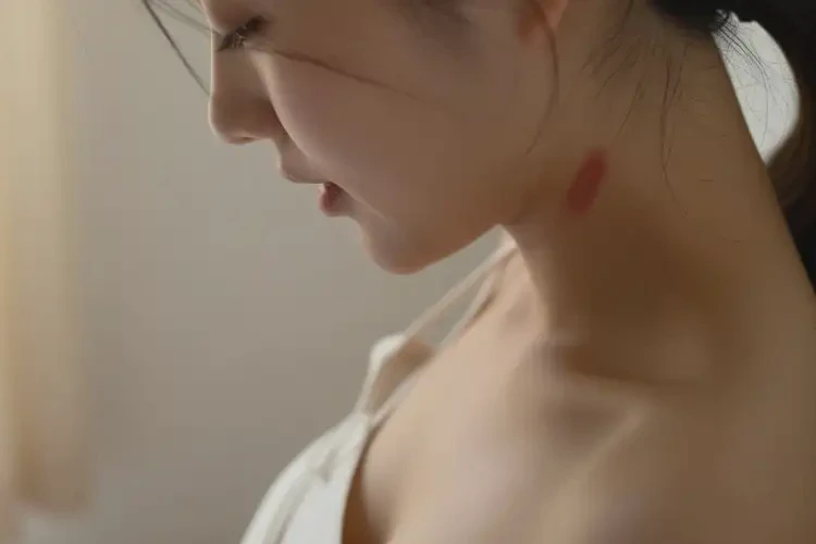 孕妇脖子出现湿疹不管它会自己痊愈吗(图4)