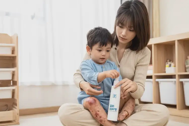 小孩身上長濕疹能靠自己自愈嗎(圖3)