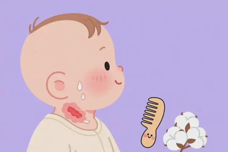 寶寶脖子經(jīng)常起濕疹能夠徹底治愈嗎(圖1)