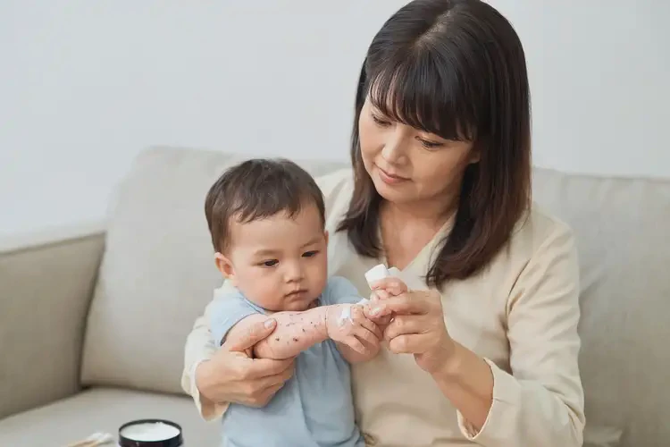 新生兒手上出現(xiàn)濕疹能夠徹底治愈嗎(圖3)