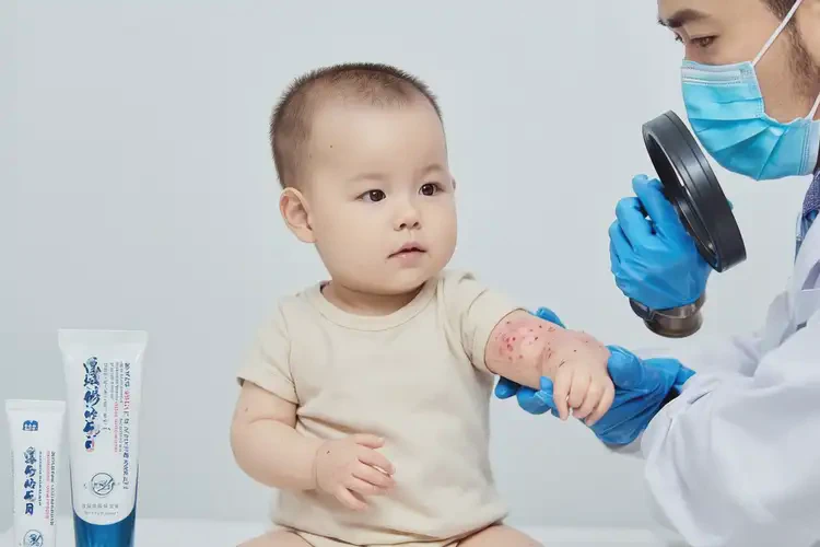 幼兒全身容易起濕疹不管它會自己痊愈嗎(圖4)