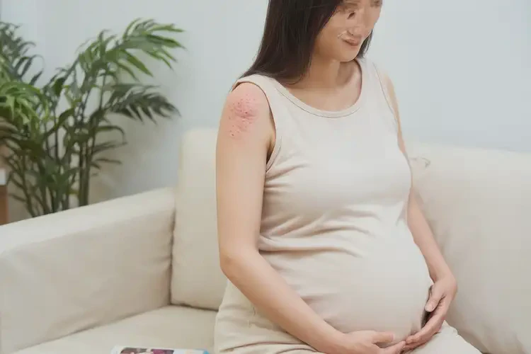 孕婦手臂偶爾起濕疹能靠自己自愈嗎(圖4)