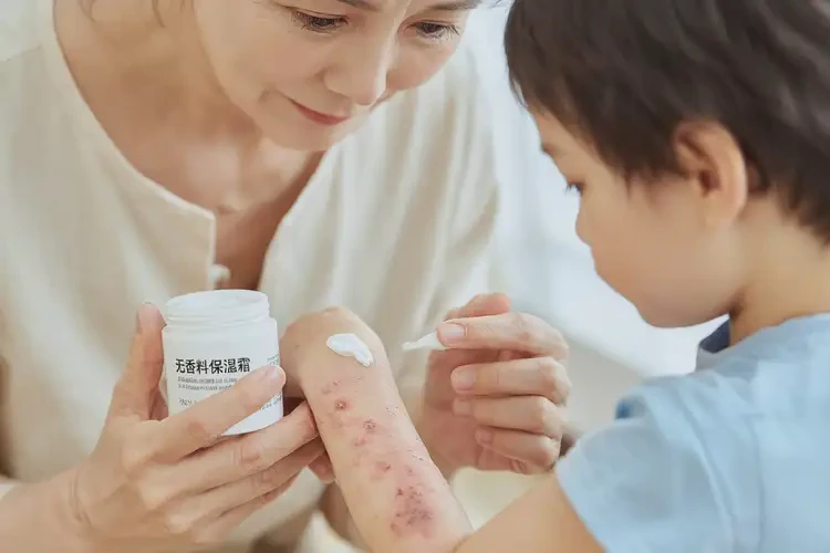 小兒身上起濕疹可以徹底自愈嗎(圖3)