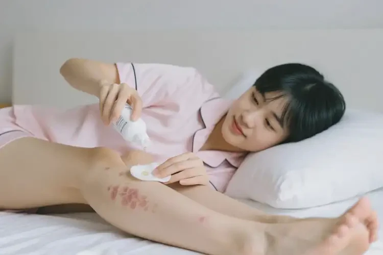 大學(xué)生四肢出現(xiàn)濕疹能夠徹底治愈嗎(圖1)