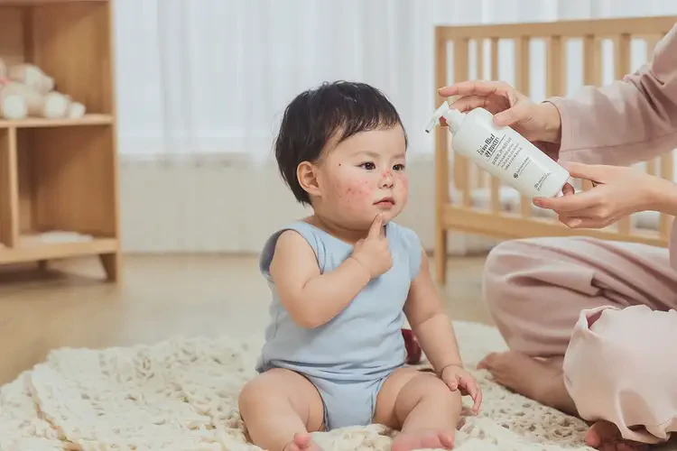 嬰幼兒面部出濕疹可以徹底自愈嗎(圖3)