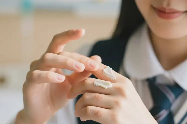 大學(xué)生四肢偶爾起濕疹能夠徹底治愈嗎(圖4)