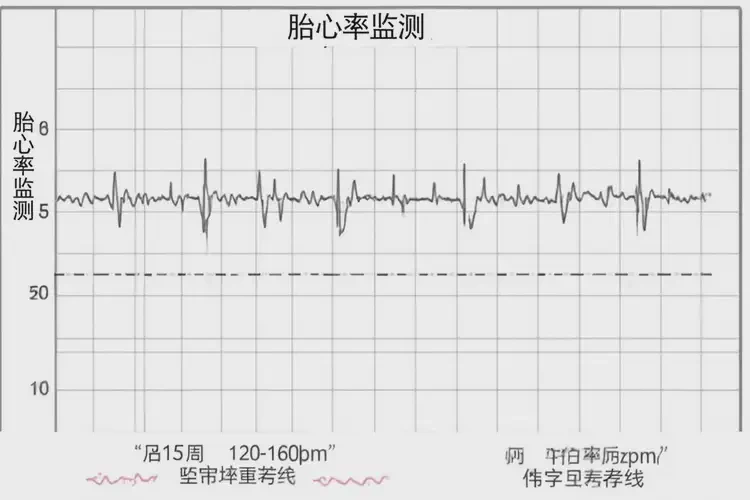 孕15周6天胎心80寶寶還能要嗎(圖4)