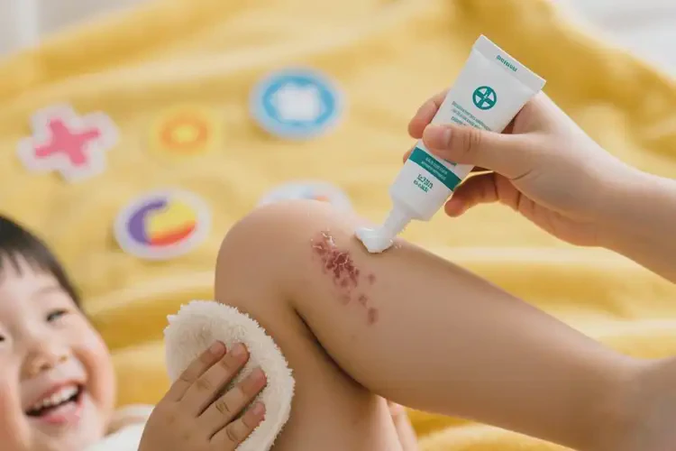 小學(xué)生小腿容易長濕疹可不可以徹底自愈(圖1)