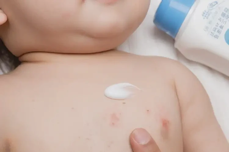 婴幼儿脖子上起湿疹能彻底自愈吗(图3)