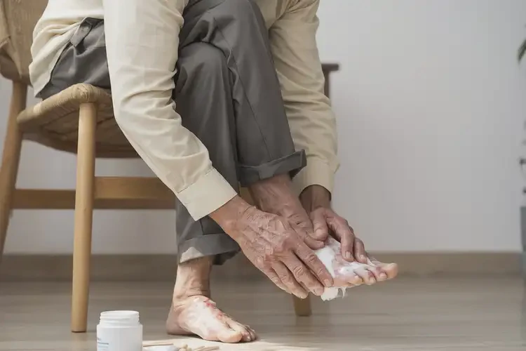 老年人脚上长湿疹能彻底自愈吗(图2)