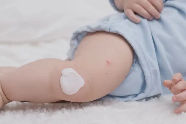 嬰兒大腿上經(jīng)常起濕疹能夠徹底治愈嗎(圖3)