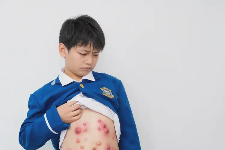 中學(xué)生肚子上起濕疹不管它會自己痊愈嗎(圖2)