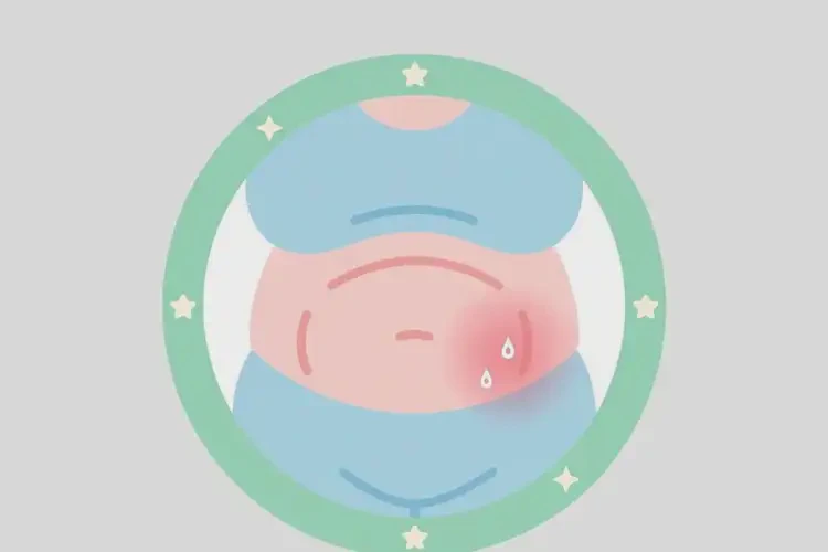 老年人肚子上偶爾起濕疹不管它會自己自愈嗎(圖1)