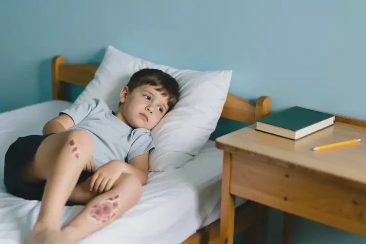 小學(xué)生小腿上有濕疹不管它會(huì)自己痊愈嗎(圖2)