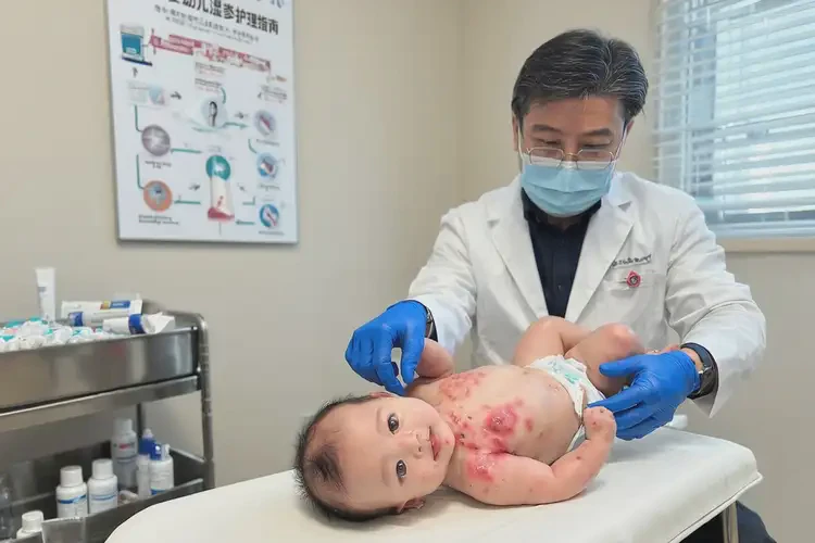 嬰幼兒脖子長濕疹不管它會自己好嗎(圖2)