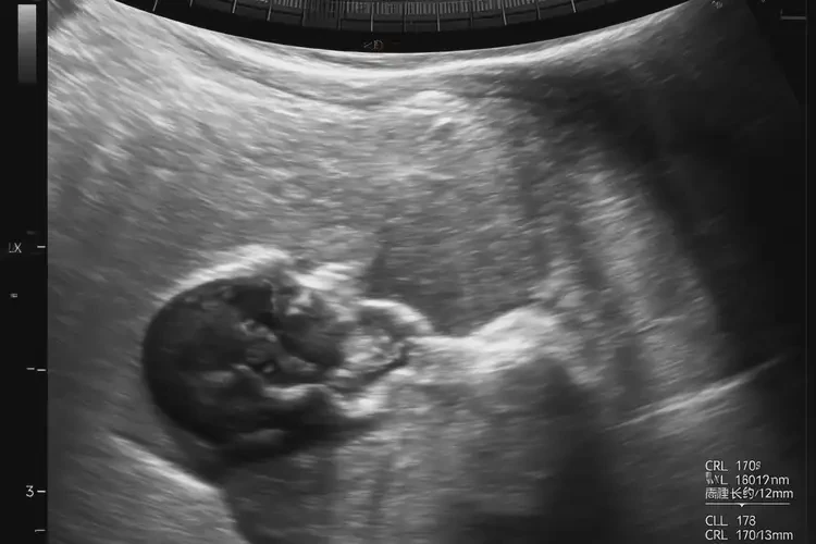 孕7周6天胎心110左右正常嗎(圖4)