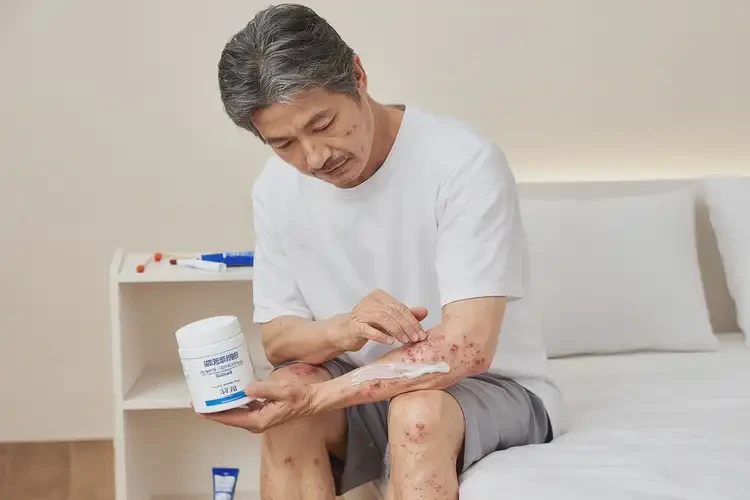 男人四肢偶爾起濕疹能徹底自愈嗎(圖1)