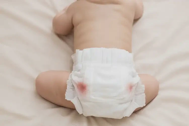 少儿屁股上经常长湿疹能靠自己自愈吗(图1)